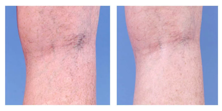 Kozmetikai korrekció